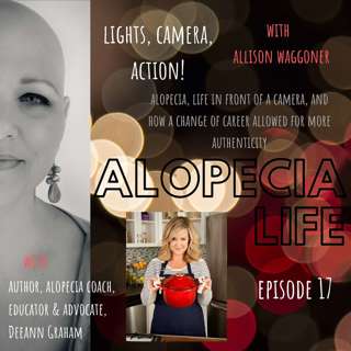 E017 Lights, Camera, Action! Alopecia, Life in Front of a Camera & How a Change of Career Allowed For More Authenticity