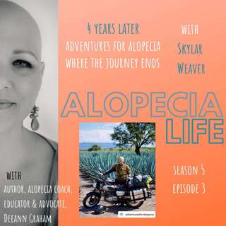 S5E3 Adventures For Alopecia - Where the Journey Ends, with Skylar Weaver