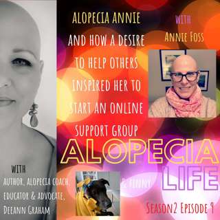 S2E9 Alopecia Annie and How a Desire to Help Others Inspired her to Start an Online Support Group