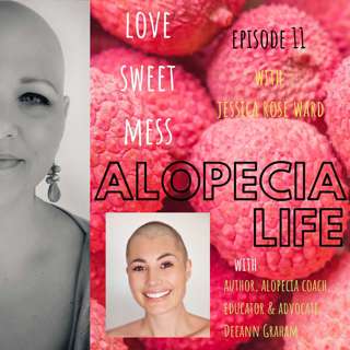 Alopecia Life