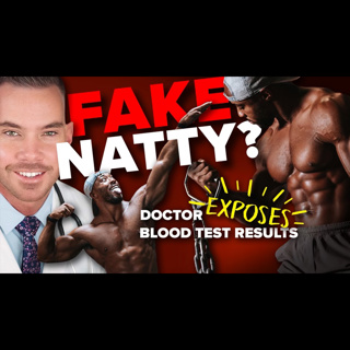 Signs of PED Abuse? Dr. Hotchkiss Analyzes Nsima’s Bloodwork || MBPP Ep. 929