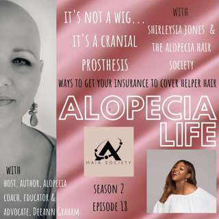 S2E18 It's Not a Wig...It's a Cranial Prosthesis - Ways to Get Your  Insurance to Cover your Helper Hair, with Shirleysia Jones & The Alopecia Hair Society