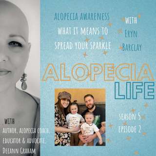 S5E2 Alopecia Awareness What it Means to Spread Your Sparkle with Eryn Barclay