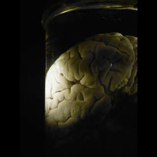 Unika ”hjärnkartan”- så kan jättesatsningen lära oss bota sjukdomar