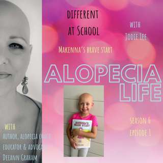 Alopecia Life