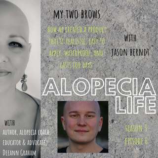 Alopecia Life