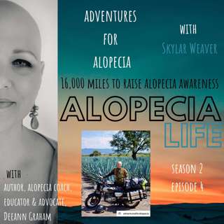 S2E04 Adventures for Alopecia - Traveling 16,000 miles to Raise Alopecia Awareness, with Skylar Weaver